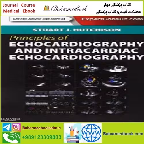 Principles of Echocardiography and Intracardiac Echocardiograph