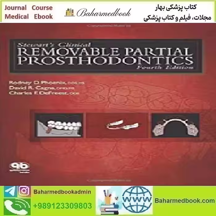 Stewart's Clinical Removable Partial Prosthodontics 2009 TR