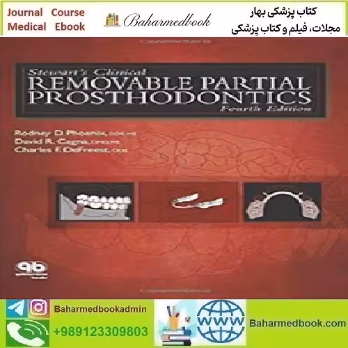 Stewart's Clinical Removable Partial Prosthodontics 2009 TR