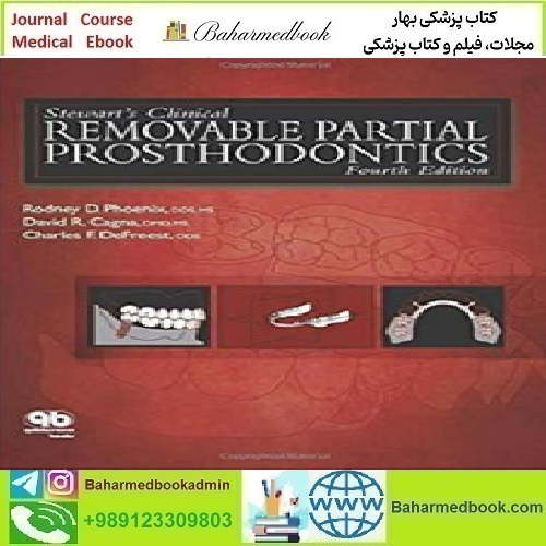 Stewart's Clinical Removable Partial Prosthodontics 2009 TR