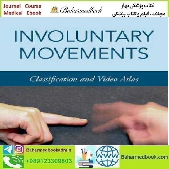 Involuntary Movements Classification And Video Atlas 2020 vide