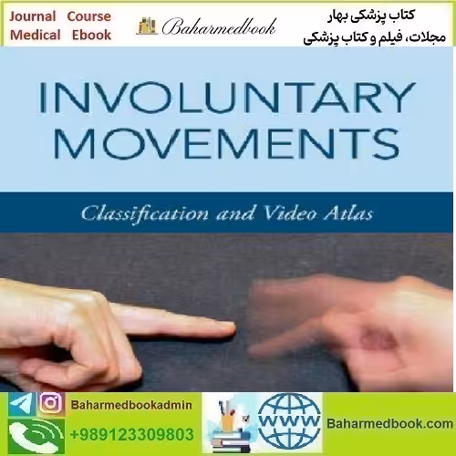 Involuntary Movements Classification And Video Atlas 2020 vide