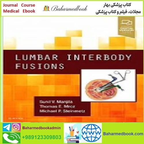 Lumbar Interbody Fusions TRUE PDF price 1€ - کتاب پزشکی بهار