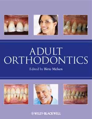 [PDF] دانلود کتاب Adult Orthodontics, 2015;2012