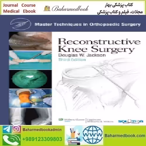 Master Techniques in Orthopaedic Surgery Reconstructive Knee