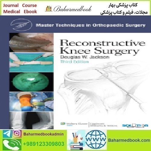 Master Techniques in Orthopaedic Surgery Reconstructive Knee