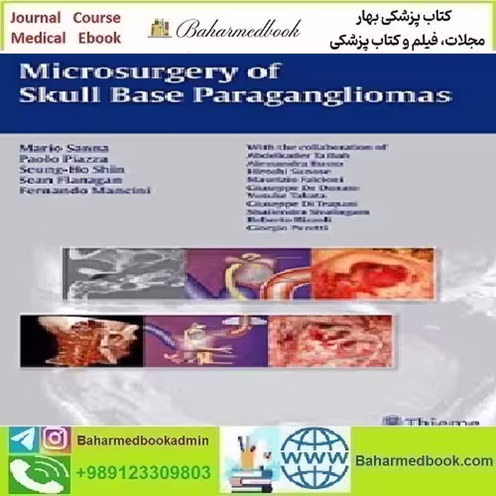 Microsurgery of Skull Base Paraganglioma