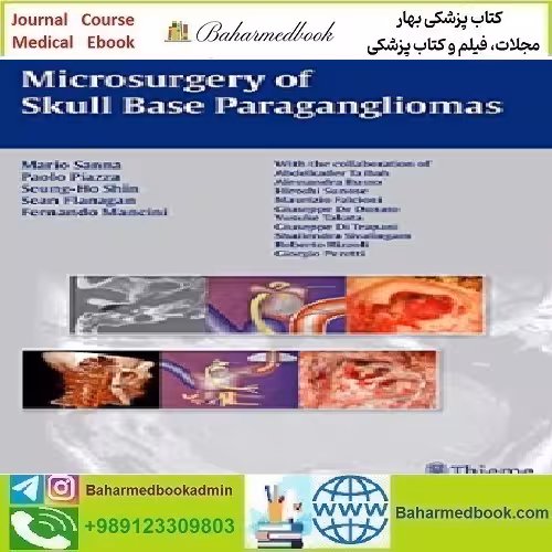 Microsurgery of Skull Base Paraganglioma