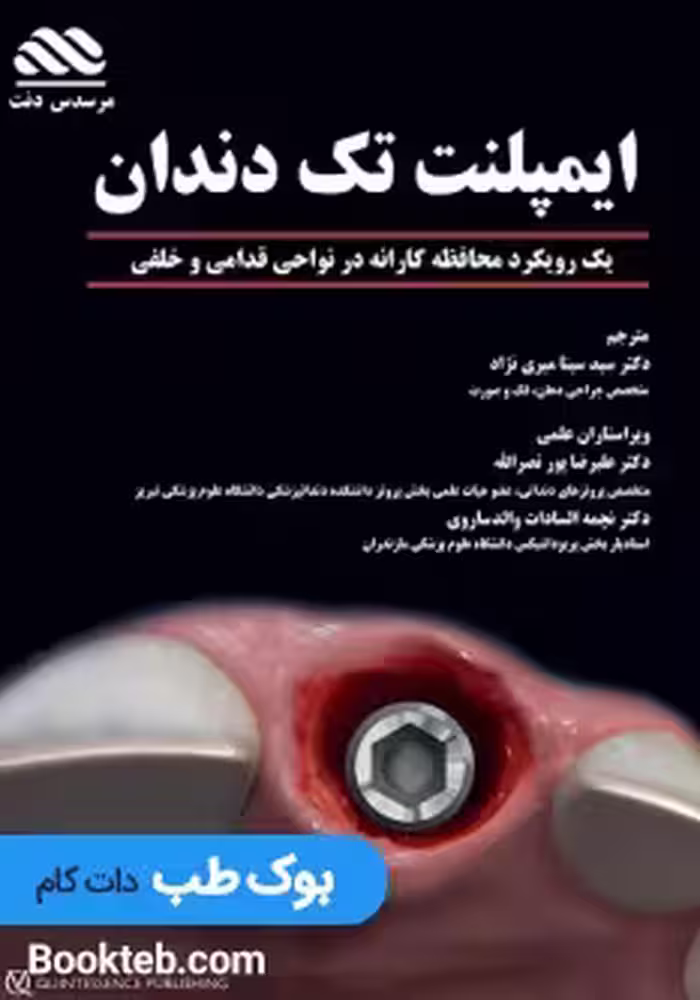 ایمپلنت تک دندان یک رویکرد محافظه کارانه در نواحی قدامی و خلفی