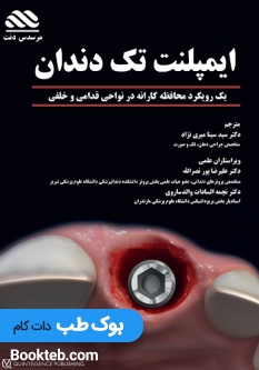 ایمپلنت تک دندان یک رویکرد محافظه کارانه در نواحی قدامی و خلفی