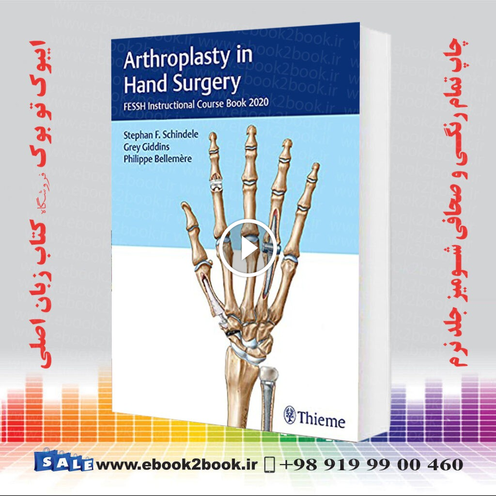 Arthroplasty in Hand Surgery: FESSH Instructional Course Book