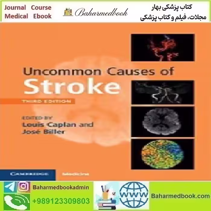 Uncommon Causes of Stroke 2018 TRUE PDF price 1€ - کتاب پزشکی بهار