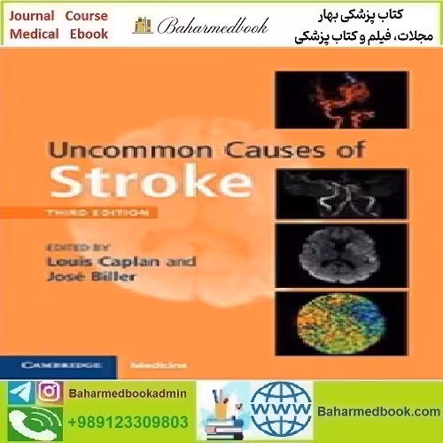 Uncommon Causes of Stroke 2018 TRUE PDF price 1€ - کتاب پزشکی بهار