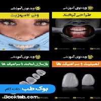 پکیج ویدئو زیبایی (1.ونیر 2.لمینیت (2 ویدئو) 3.طراحی لبخند) (انگلیسی)