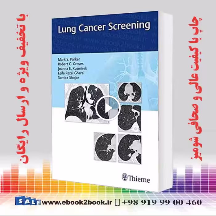 Lung Cancer Screening