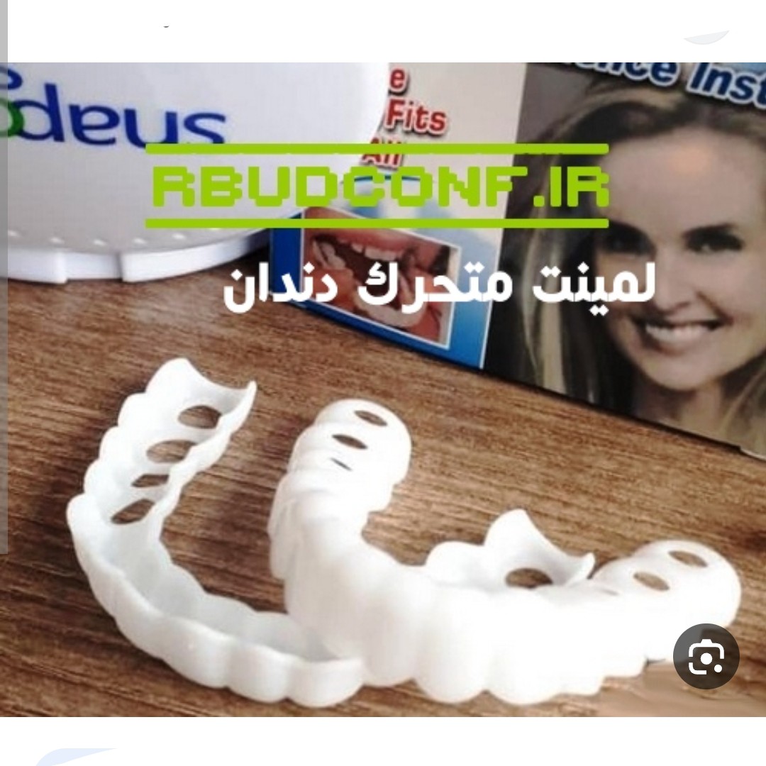 لمینت متحرک دندان(زاهدان انلاین)