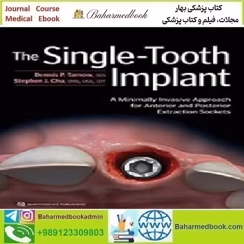 The Single Tooth Implant 2020 TRUE PDF price 1€ - کتاب پزشکی بهار