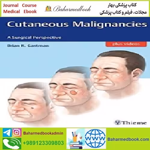 Cutaneous Malignancies TRUE PDF price 1€ - کتاب پزشکی بهار