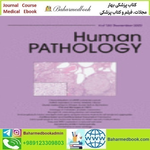 Human Pathology Volume 119 to 130 2022 TRUE PDF price 36€ - کتاب پزشکی بهار