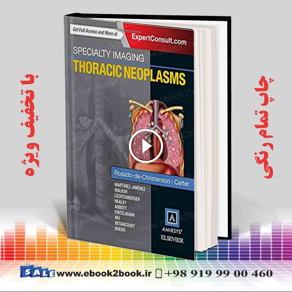 Specialty Imaging: Thoracic Neoplasms
