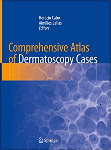  دانلود کتاب Comprehensive Atlas Of Dermatoscopy Cases, 2018 - دانلود کتاب های دانشگاهی