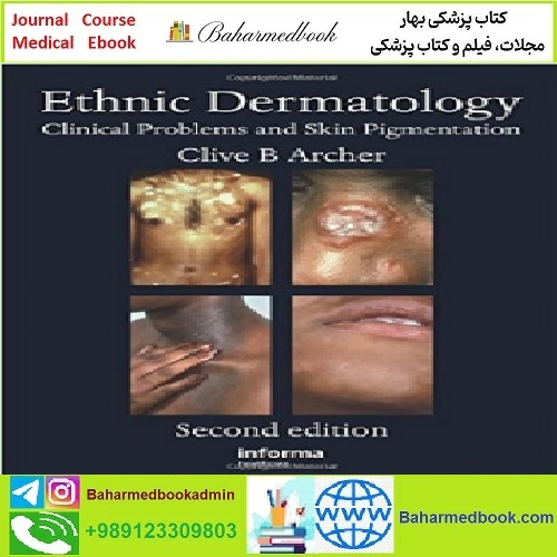 Ethnic Dermatology Clinical Problems and Skin Pigmentation TRU