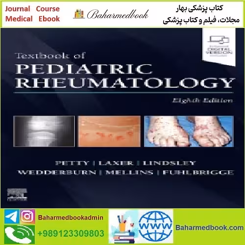 Textbook of Pediatric Rheumatology TRUE PDF price 1€ - کتاب پزشکی بهار