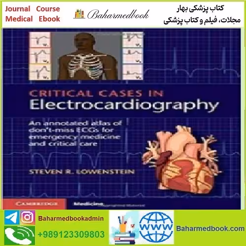 Critical Cases in Electrocardiography TRUE PDF price 1€ - کتاب پزشکی بهار