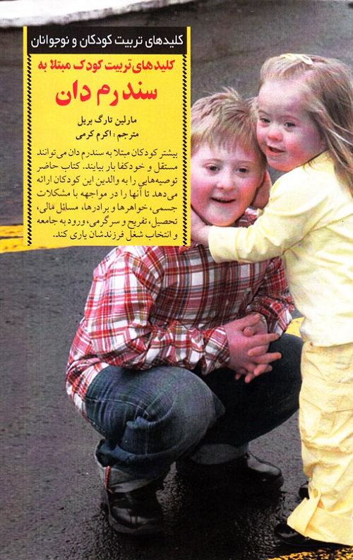 کلیدهای تربیت کودک مبتلا به سندرم دان