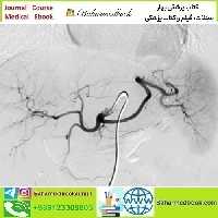 NYU Langone Vascular and Interventional Radiolo