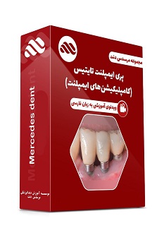 ویدئوی پری ایمپلنت تایتیس(کامپلیکیشن های ایمپلنت)