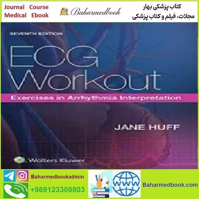 ECG Workout CONVERTEF PDF price 1€ - کتاب پزشکی بهار