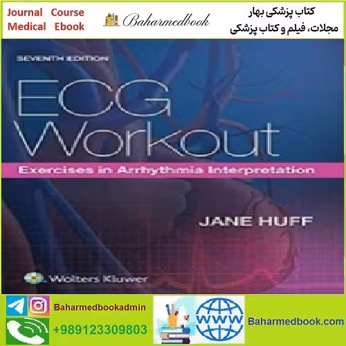 ECG Workout CONVERTEF PDF price 1€ - کتاب پزشکی بهار