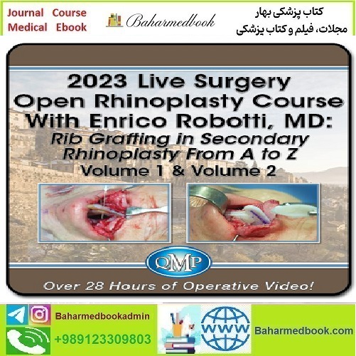 QMP 2023 Live Surgery Open Rhinoplasty Course With Enrico Rob