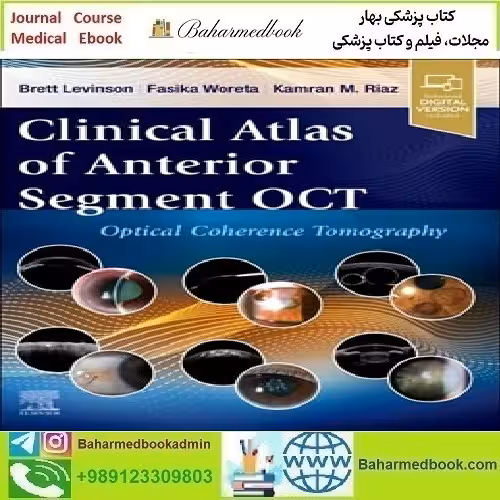 Clinical Atlas of Anterior Segment OCT Optical Coherence