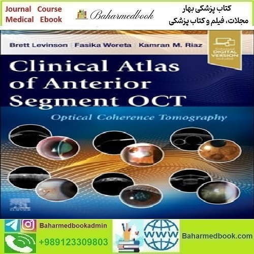 Clinical Atlas of Anterior Segment OCT Optical Coherence