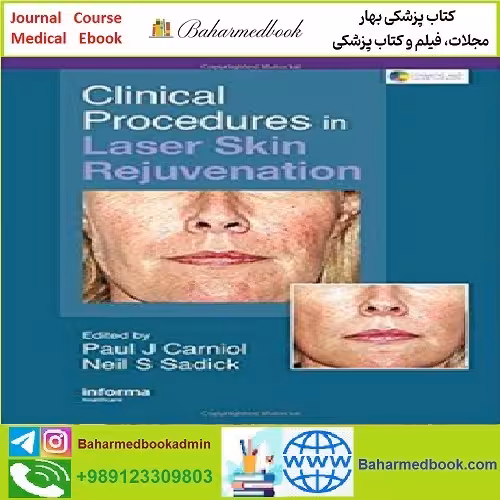 Clinical Procedures in Laser Skin Rejuvenation TRUE PDF price 1€ - کتاب پزشکی بهار
