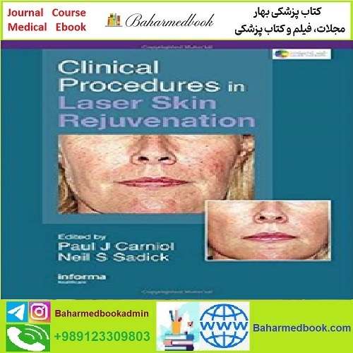 Clinical Procedures in Laser Skin Rejuvenation TRUE PDF price 1€ - کتاب پزشکی بهار