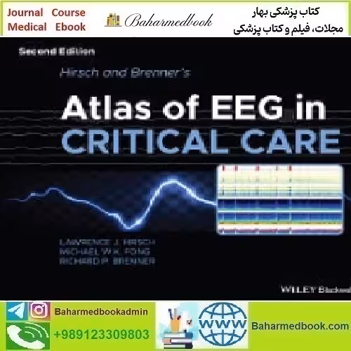 Hirsch and Brenner's Atlas of EEG in Critical Care 2023 TRUE