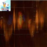 Mayo Clinic Echocardiography Online Board Review 2021-Videos PDFs at 70€ - کتاب پزشکی بهار