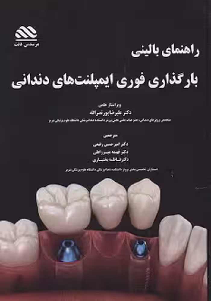 راهنمای بالینی بارگذاری فوری ایمپلنت های دندانی