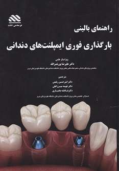 راهنمای بالینی بارگذاری فوری ایمپلنت های دندانی