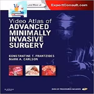 Video Atlas of Advanced Minimally Invasive Surgery