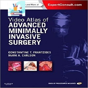 Video Atlas of Advanced Minimally Invasive Surgery