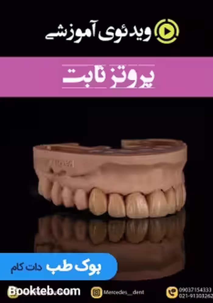 ویدئوی جامع پروتز ثابت (انگلیسی)
