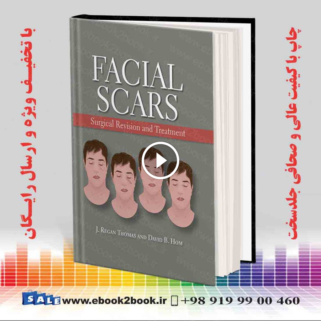 Facial Scars: Surgical Revision and Treatment