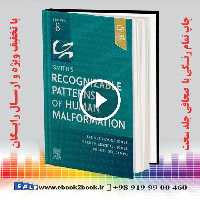 Smith’s Recognizable Patterns of Human Malformation 8th Edition
