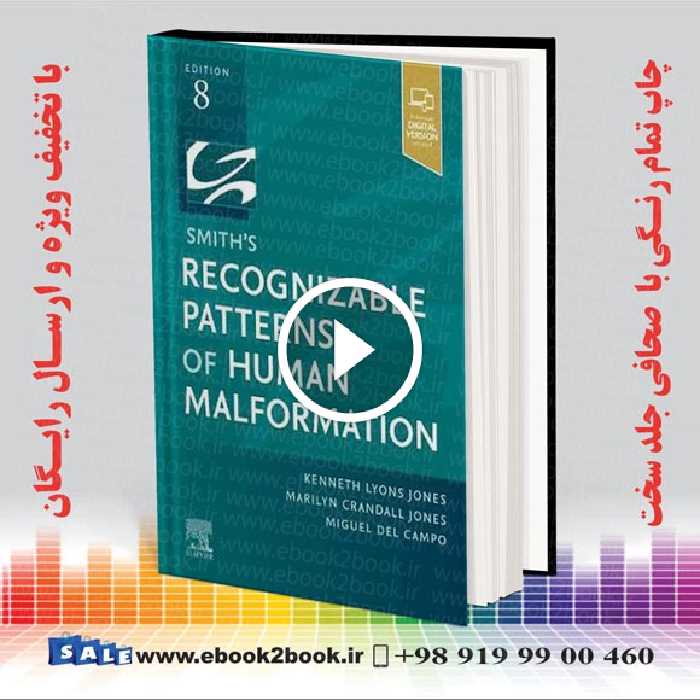 Smith’s Recognizable Patterns of Human Malformation 8th Edition
