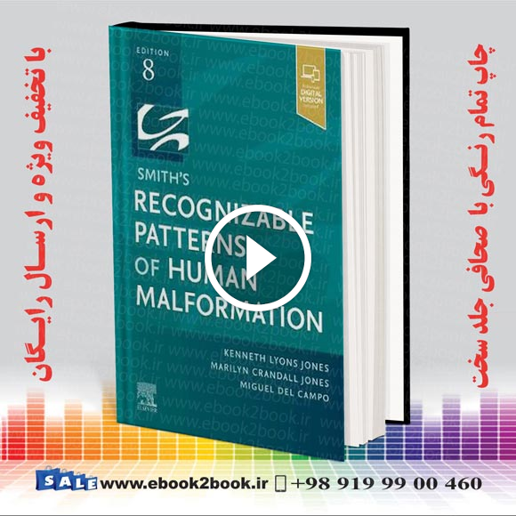Smith’s Recognizable Patterns of Human Malformation 8th Edition