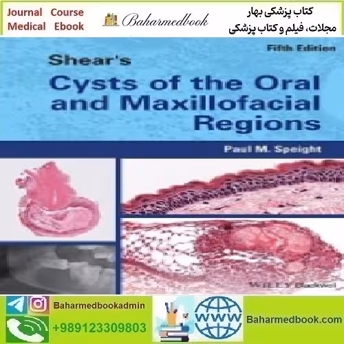 Shear's Cysts of the Oral and Maxillofacial Regions